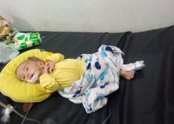 Baru Setahun, Naail Ziyan Al Fatih Berjuang Melawan Hidrosefalus, Uluran Tangan Dibutuhkan