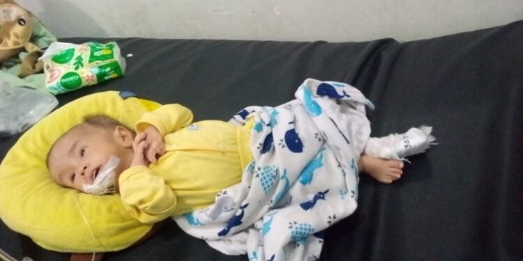 Baru Setahun, Naail Ziyan Al Fatih Berjuang Melawan Hidrosefalus, Uluran Tangan Dibutuhkan